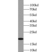 WB analysis of Jurkat cells, using IL4 antibody (1/1000 dilution).