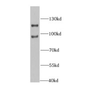 WB analysis of mouse spleen tissue, using NF90, ILF3 antibody (1/1000 dilution).