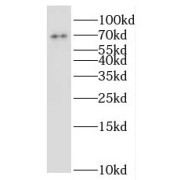 WB analysis of HepG2 cells, using ILVBL antibody (1/1000 dilution).