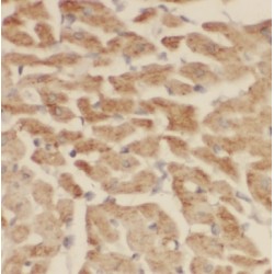 Acetolactate Synthase Like Protein (ILVBL) Antibody