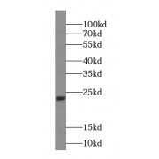 WB analysis of HeLa cells, using IMP3 antibody (1/2000 dilution).
