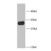 WB analysis of human kidney tissue, using IMPA1 antibody (1/1000 dilution).