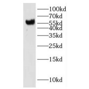 WB analysis of human heart tissue, using IMPDH2 antibody (1/400 dilution).