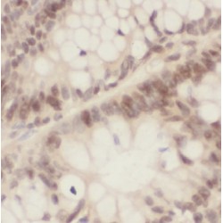 Inhibitor of Growth Protein 2 (ING2) Antibody