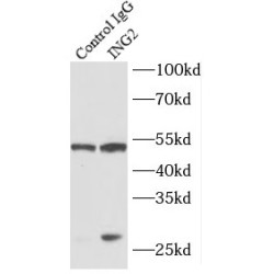 Inhibitor of Growth Protein 2 (ING2) Antibody