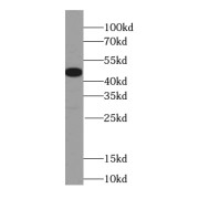 WB analysis of human kidney tissue, using ING3-specific antibody (1/500 dilution).