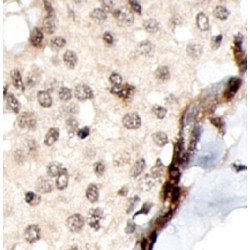 Inhibitor of Growth Protein 4 (ING4) Antibody