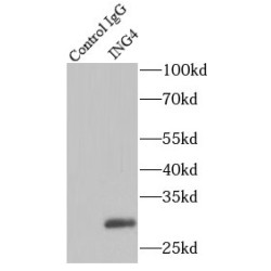 Inhibitor of Growth Protein 4 (ING4) Antibody