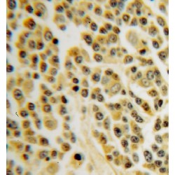 Type II Inositol-1,4,5-Trisphosphate 5-Phosphatase (INPP5B) Antibody