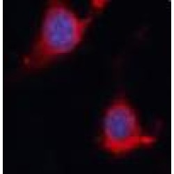 Phosphatidylinositol-3,4,5-Trisphosphate 5-Phosphatase 1 (INPP5D) Antibody