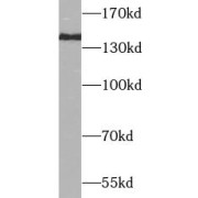 WB analysis of Jurkat cells, using INPP5D antibody (1/1000 dilution).