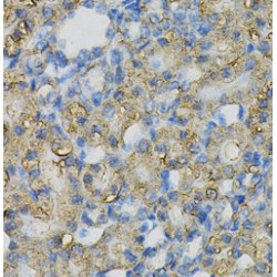 Inositol Polyphosphate-5-Phosphatase J (INPP5J) Antibody