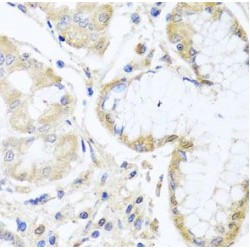 Inositol Polyphosphate 5-Phosphatase K (INPP5K) Antibody