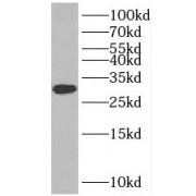 WB analysis of rat liver tissue, using INSIG2 antibody (1/1000 dilution).