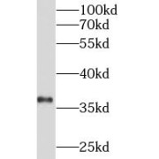 WB analysis of mouse pancreas tissue, using INS antibody (1/1000 dilution).