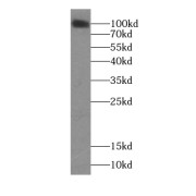 WB analysis of human liver tissue, using ITGA9 antibody (1/400 dilution).