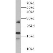 WB analysis of HL60 cells, using Interferon alpha antibody (1/1000 dilution).