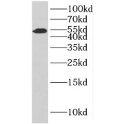 Western blot analysis of HepG2 cells, using Integrator Complex Subunit 12 Antibody (1/1000 dilution).