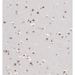 Integrator Complex Subunit 7 (INTS7) Antibody