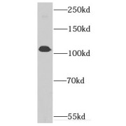 WB analysis of HEK-293 cells, using INTS7 antibody (1/500 dilution).