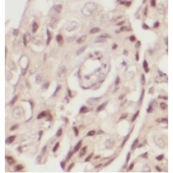 Integrator Complex Subunit 8 (INTS8) Antibody