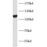 WB analysis of MCF7 cells, using INTS8 antibody (1/300 dilution).