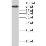 WB analysis of Jurkat cells, using INTS9 antibody (1/1000 dilution).