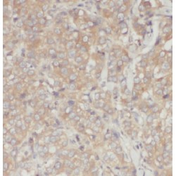 Inversin (INVS) Antibody