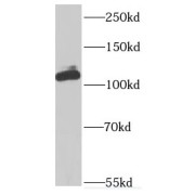 WB analysis of MCF7 cells, using INVS antibody (1/100 dilution).