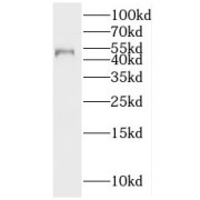 WB analysis of human adrenal gland tissue, using IP6K2 antibody (1/500 dilution).