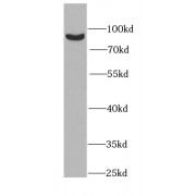 WB analysis of mouse testis tissue, using PLA2G6 antibody (1/1000 dilution).