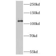 WB analysis of human testis tissue, using IPO11 antibody (1/1000 dilution).