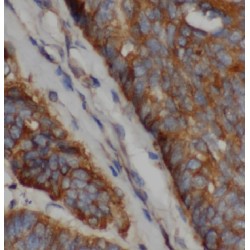 IQ Motif Containing GTPase Activating Protein 2 (IQGAP2) Antibody