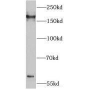 WB analysis of HepG2 cells, using IQGAP2 antibody (1/300 dilution).