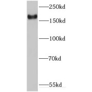 WB analysis of A549 cells, using IQGAP3 antibody (1/2000 dilution).