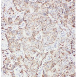 Interferon Regulatory Factor 1 (IRF1) Antibody