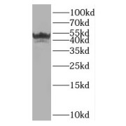 WB analysis of Raji cells, using IRF1 antibody (1/300 dilution).