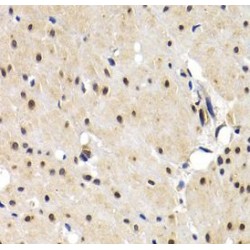 Interferon Regulatory Factor 2 (IRF2) Antibody