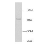 WB analysis of Jurkat cells, using IRF2 antibody (1/1000 dilution).