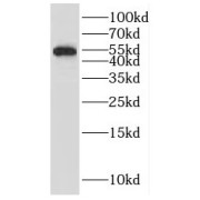 WB analysis of mouse spleen tissue, using IRF4 antibody (1/1000 dilution).