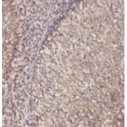 Interferon Regulatory Factor 7 (IRF7) Antibody