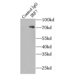 Interferon Regulatory Factor 7 (IRF7) Antibody