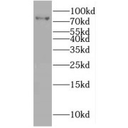 WB analysis of HEK-293 cells, using IRF7 antibody (1/600 dilution).