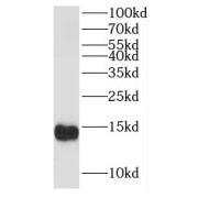 WB analysis of A431 cells, using ISCA2 antibody (1/300 dilution).