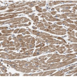 Integrin Beta-1-Binding Protein 1 (ITGB1BP1) Antibody