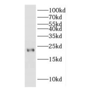 WB analysis of PC-3 cells, using ITGB1BP1 antibody (1/300 dilution).