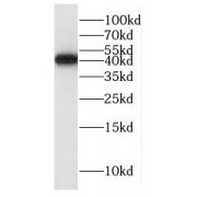 WB analysis of human heart tissue, using ITGB1BP2 antibody (1/600 dilution).