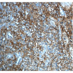 Inter-Alpha-Trypsin Inhibitor Heavy Chain H3 (ITIH3) Antibody