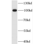 WB analysis of human serum tissue, using ITIH3 antibody (1/1000 dilution).