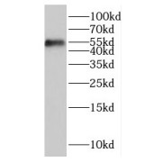 WB analysis of mouse brain tissue, using ITPKA antibody (1/500 dilution).